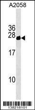 Anti-CYorf15B (Center) Antibody