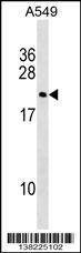 Anti-DUX3 (N-term) Antibody