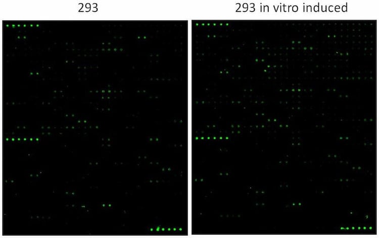 Human Protein S-Acylation Array G1