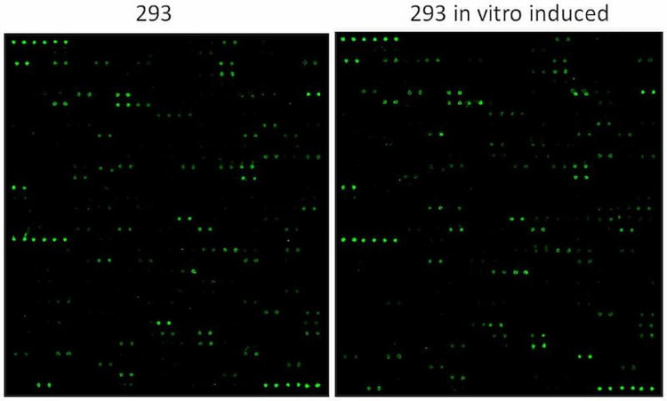 Human Protein S-Acylation Array G2