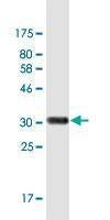 Anti-DUSP5 Antibody