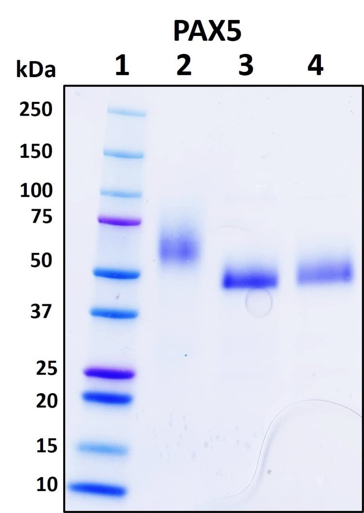 Figure 1. Deglycosylation analysis of purified recombinant proteins. Lane 1, protein ladder (kDa). Lane 2, glycosylated protein (delivered to customers). Lanes 3 and 4, deglycosylated proteins under native and denature conditions respectively.