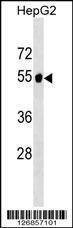 Anti-GPT2 (N-term) Antibody