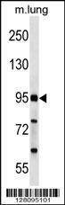 Anti-FCHO2 (Center) Antibody