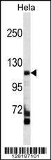 Anti-FAM65C (C-term) Antibody