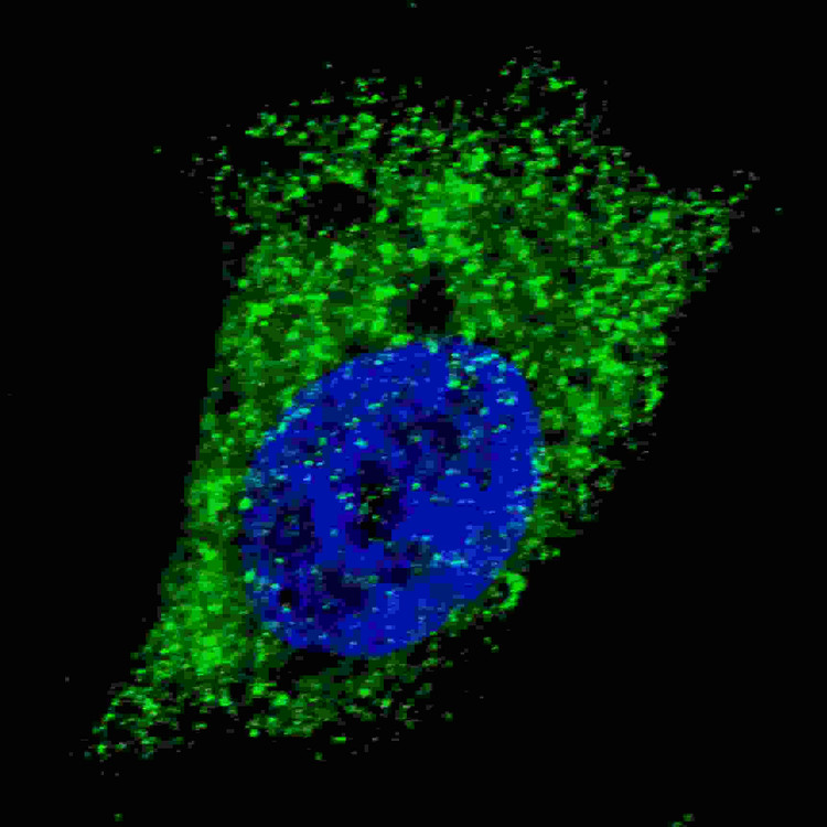Anti-Cleaved LC3A Antibody