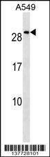 Anti-NKX2-8 (N-term) Antibody
