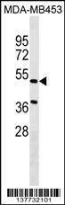 Anti-NPNT (Center) Antibody