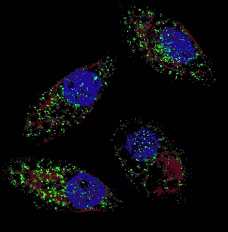 Anti-Cleaved LC3B Antibody