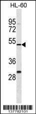 Anti-ZNF187 (N-term) Antibody