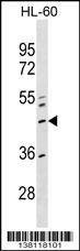 Anti-ZNF589 (Center) Antibody