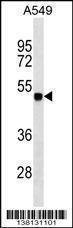 Anti-ZSCAN1 (C-term) Antibody