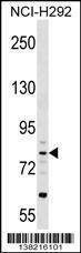 Anti-CRTAC1 (N-term) Antibody