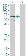 Anti-DYRK2 Antibody