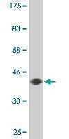 Anti-DYRK2 Antibody