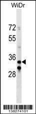 Anti-ITGB1BP2 (C-term) Antibody