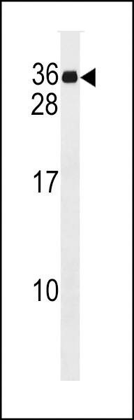 Anti-MND1 (C-term) Antibody