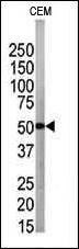 Anti-ATG4B (N-term) Antibody