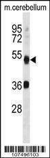Anti-ATG4B (N-term) Antibody