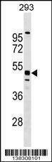 Anti-MTL5 (C-term) Antibody