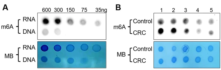 m6A (N6-methyladenosine) Dot Blot Assay Kit