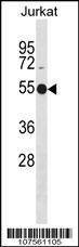 Anti-ATG4C (N-term) Antibody