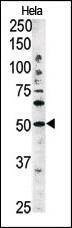 Anti-ATG4C (Center) Antibody