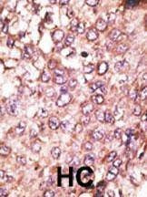 Anti-ATG4C (Center) Antibody
