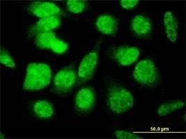 Anti-E4F1 Antibody