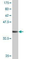 Anti-E4F1 Antibody