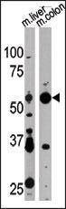Anti-ATG4D (N-term) Antibody