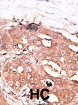 Anti-ATG4D (N-term) Antibody