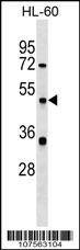Anti-ATG4D (N-term) Antibody