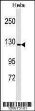 Anti-GTF2IRD1 (N-term) Antibody