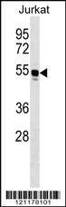 Anti-WARS (C-term) Antibody