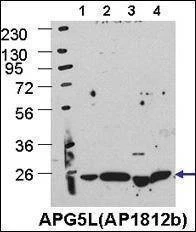 Anti-ATG5 (C-term) Antibody