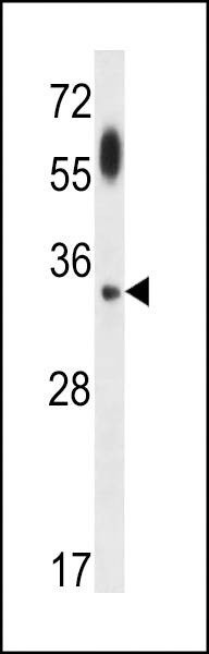 Anti-ATG5 Antibody