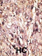 Anti-ATG7 Antibody