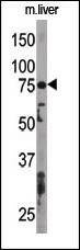 Anti-ATG7 Antibody