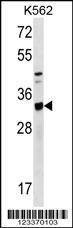 Anti-TIPRL (C-term) Antibody