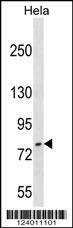 Anti-FASTKD3 (C-term) Antibody