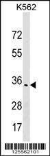 Anti-OR1F1 (C-term) Antibody