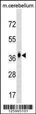 Anti-MMD2 (N-term) Antibody