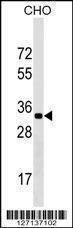 Anti-CCDC75 (N-term) Antibody