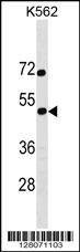 Anti-SS18L1 (Center) Antibody