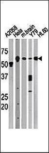 Anti-Beclin 1 Antibody