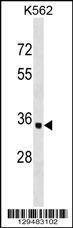 Anti-OR10AD1 (Center) Antibody