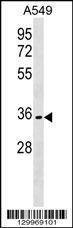 Anti-OR51B6 (C-term) Antibody