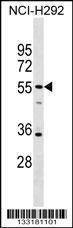 Anti-SPATA21 (C-term) Antibody