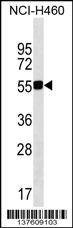 Anti-QRSL1 (N-term) Antibody